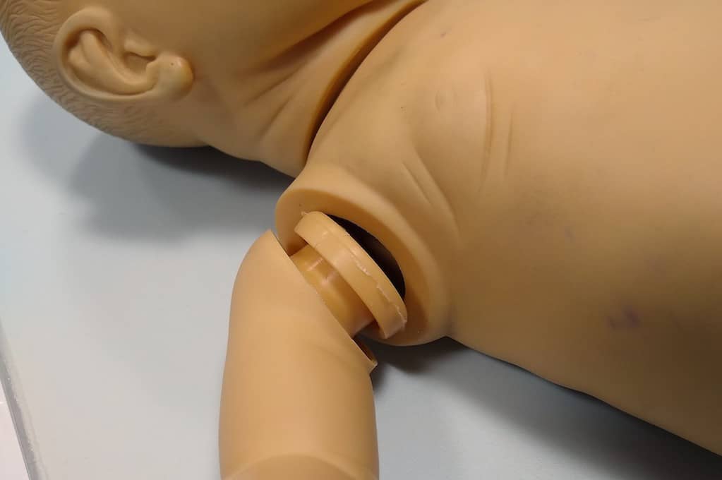 photo of baby doll torso with detached arm