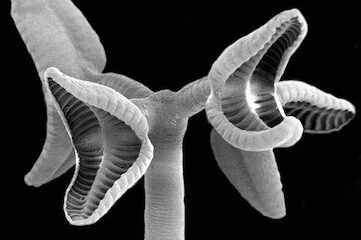 close-up picture of tapeworm